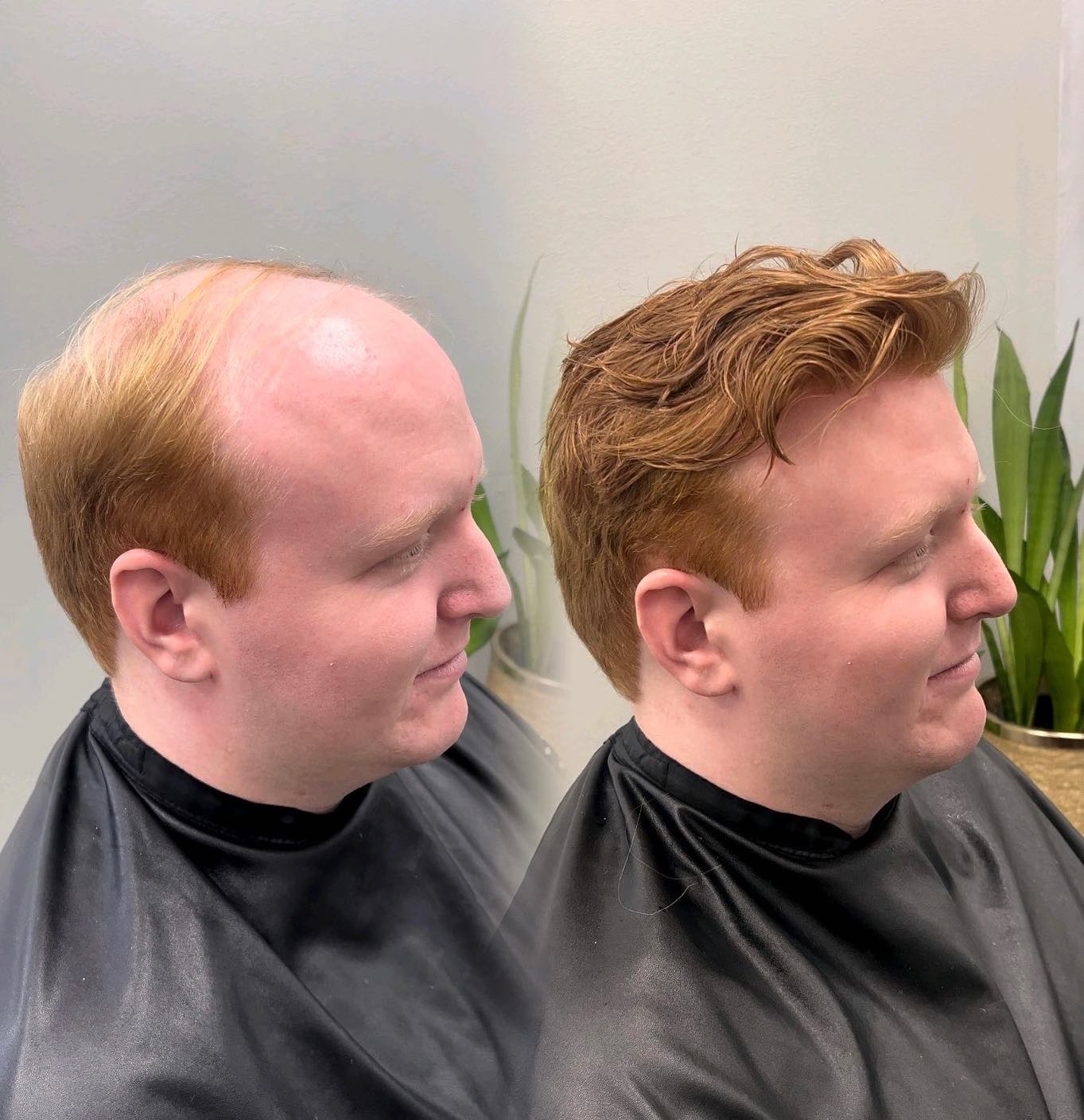 Side-profile before and after example of a men's hair system