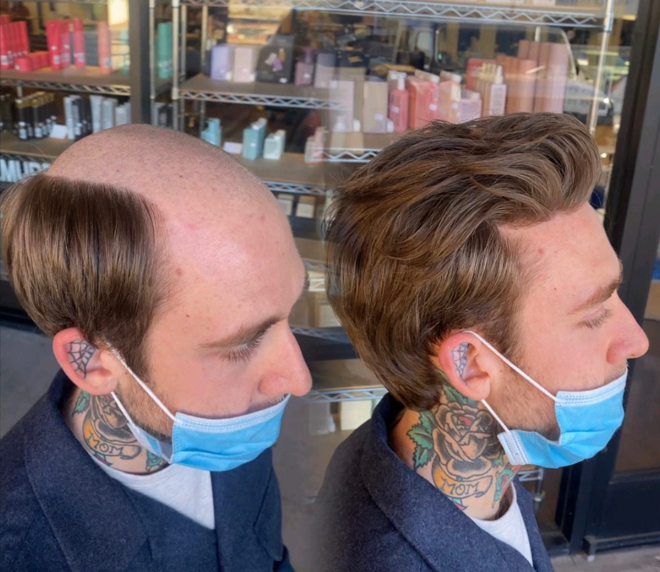 Hair system consultation example