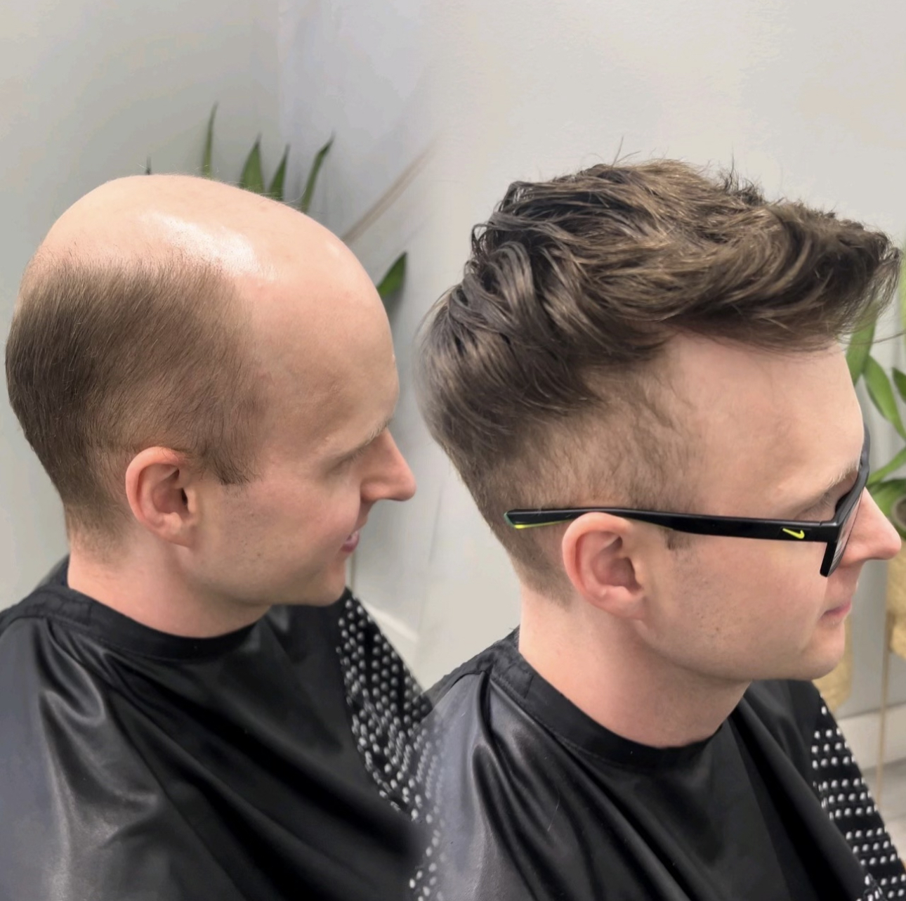 Hair system style example for a consultation