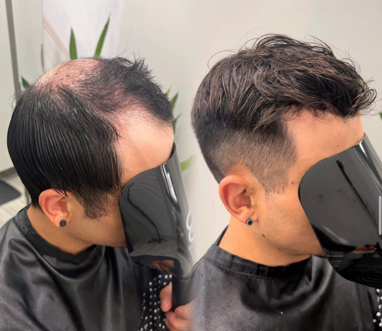 Before and after hair system style example