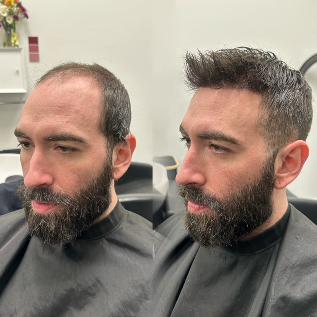 Hair system style example for a bearded client