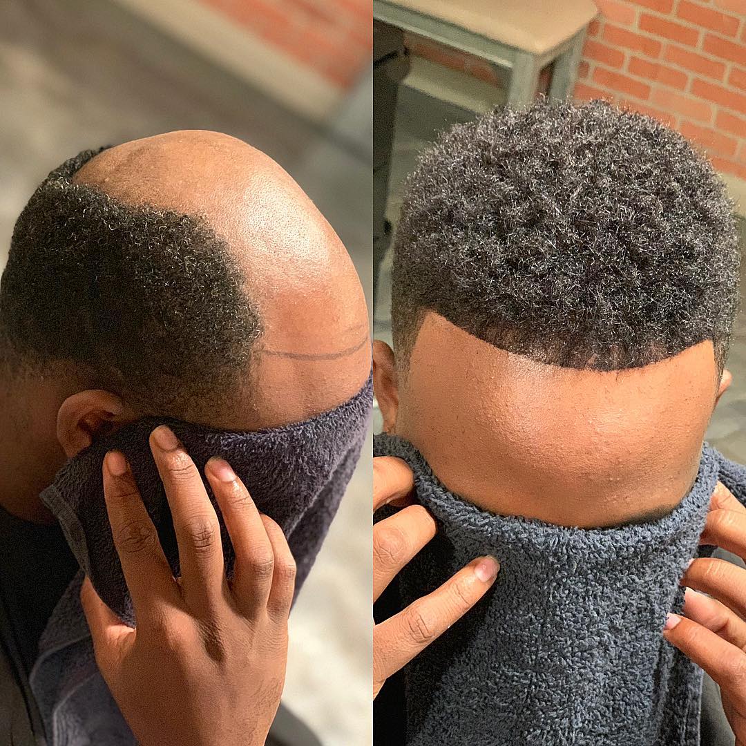 Short hair unit before and after example